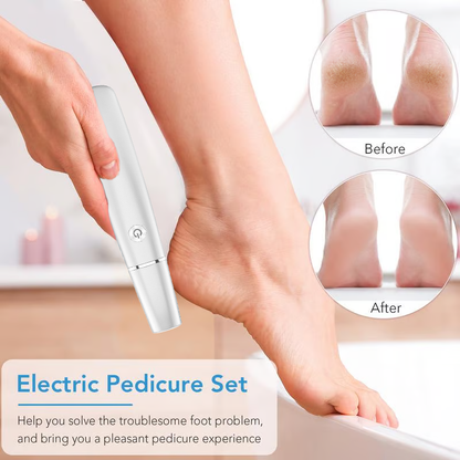 💥Offre limitée dans le temps 49 % RÉDUCTION🔥⚡Extracteur électrique de callosités pour les pieds